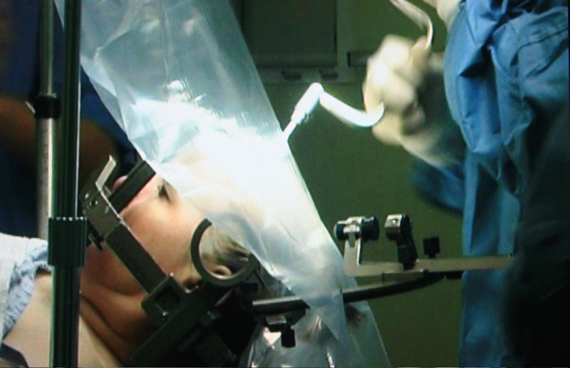 Brain Surgeon